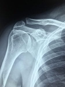 arm-4813365_1280